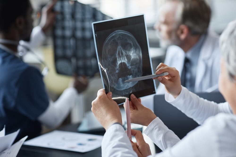 brain injury lawyer in indianapolis